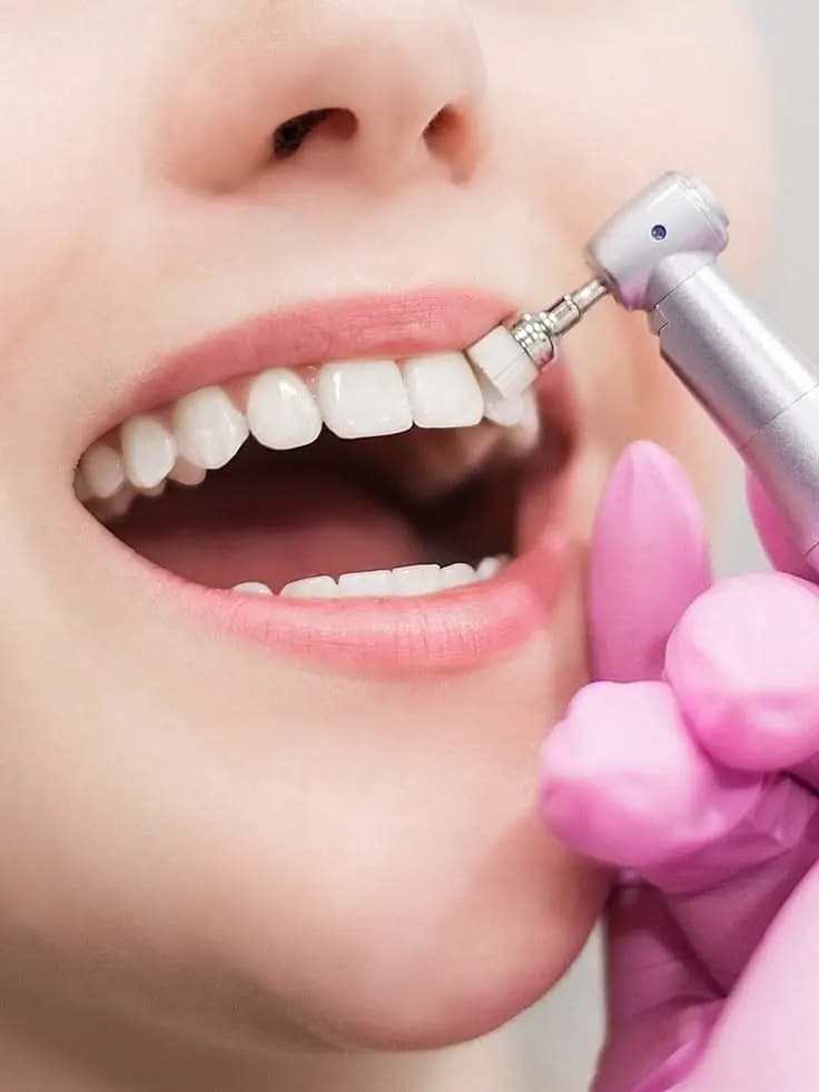 Soins Dentaires Adulte & Enfant